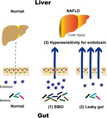 Endotoxins and Non-Alcoholic Fatty Liver Disease